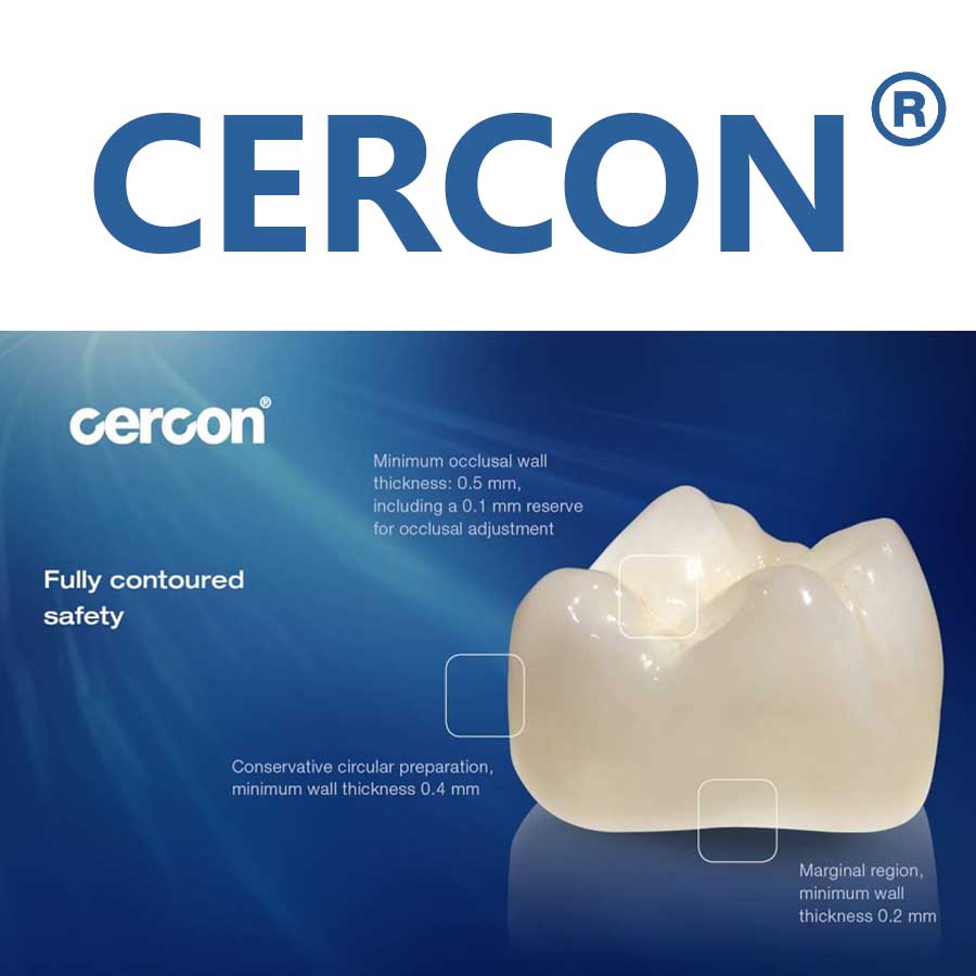 SỨ CERCON